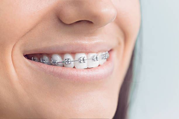 Best Traditional Braces  in Exander City, AL
